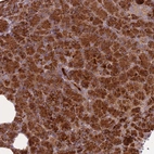 Immunohistochemical staining of human pancreas shows strong cytoplasmic positivity in exocrine glandular cells.