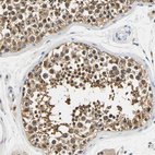Anti-UCHL3 Antibody