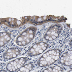 Immunohistochemical staining of human colon shows moderate to strong cytoplasmic positivity in glandular cells.