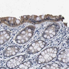 Immunohistochemical staining of human colon shows moderate to strong cytoplasmic positivity in glandular cells.