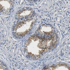 Anti-UCHL3 Antibody