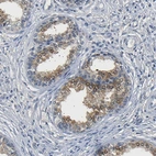 Immunohistochemical staining of human prostate shows weak to moderate cytoplasmic positivity in glandular cells.