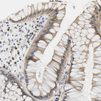 Immunohistochemical staining of human rectum shows moderate cytoplasmic positivity in glandular cells.