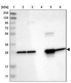 Lane 1: Marker [kDa] 230, 130, 95, 72, 56, 36, 28, 17, 11_br/_Lane 2: Human cell line RT-4_br/_Lane 3: Human cell line U-251MG sp_br/_Lane 4: Human plasma (IgG/HSA depleted)_br/_Lane 5: Human liver tissue_br/_Lane 6: Human tonsil tissue