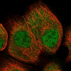 Anti-UCHL3 Antibody