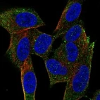 Anti-NRSN1 Antibody