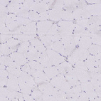Immunohistochemical staining of human skeletal muscle shows no positivity in myocytes as expected.