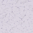 Immunohistochemical staining of human skeletal muscle shows no positivity in myocytes as expected.