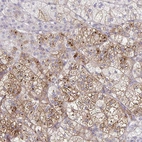 Immunohistochemical staining of human adrenal gland shows moderate to strong cytoplasmic positivity in glandular cells.