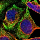 Immunofluorescent staining of human cell line U-2 OS shows localization to vesicles.