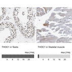 Anti-THOC1 Antibody