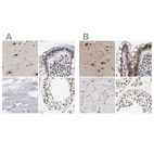 Immunohistochemical staining of human cerebral cortex, colon, skeletal muscle and testis using Anti-THOC1 antibody HPA019687 (A) shows similar protein distribution across tissues to independent antibody HPA019096 (B).