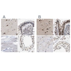 Immunohistochemical staining of human cerebral cortex, colon, skeletal muscle and testis using Anti-THOC1 antibody HPA019687 (A) shows similar protein distribution across tissues to independent antibody HPA019096 (B).