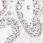 Immunohistochemical staining of human testis shows high expression.