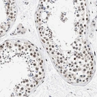 Immunohistochemical staining of human testis shows high expression.