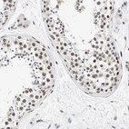 Immunohistochemical staining of human testis shows moderate nuclear positivity in cells in seminiferous ducts.
