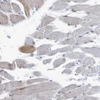 Immunohistochemical staining of human skeletal muscle shows low expression as expected.