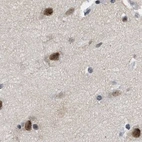 Immunohistochemical staining of human cerebral cortex using Anti-THOC1 antibody HPA019687.
