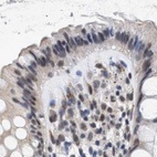 Immunohistochemical staining of human colon using Anti-THOC1 antibody HPA019687.