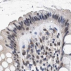 Immunohistochemical staining of human colon using Anti-THOC1 antibody HPA019687.