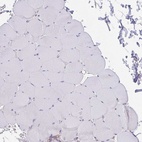 Immunohistochemical staining of human skeletal muscle shows low expression as expected.