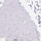 Immunohistochemical staining of human skeletal muscle shows low expression as expected.
