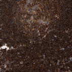 Immunohistochemical staining of human lymph node shows high expression.