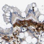 Immunohistochemical staining of human colon using Anti-FNBP1 antibody HPA019691.