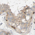 Immunohistochemical staining of human testis using Anti-FNBP1 antibody HPA019691.