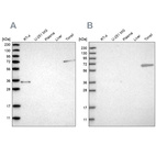 Western blot analysis using Anti-FNBP1 antibody HPA019691 (A) shows similar pattern to independent antibody HPA022119 (B).