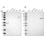 Western blot analysis using Anti-FNBP1 antibody HPA019691 (A) shows similar pattern to independent antibody HPA022119 (B).