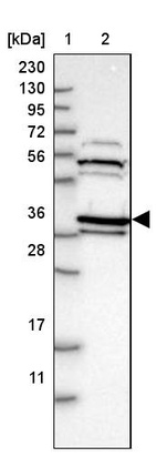 Lane 1: Marker [kDa] 230, 130, 95, 72, 56, 36, 28, 17, 11_br/_Lane 2: Human cell line RT-4