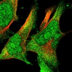 Immunofluorescent staining of human cell line U-251 MG shows localization to nucleus, nucleoli & cytosol.