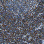 Immunohistochemical staining of human tonsil shows strong membranous positivity in non-germinal center cells.