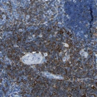 Immunohistochemical staining of human lymph node shows strong membranous positivity in non-germinal center cells.