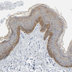 Anti-KRT76 Antibody