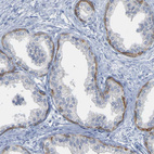 Immunohistochemical staining of human prostate shows strong cytoplasmic positivity in basal glandular cells.