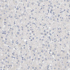 Immunohistochemical staining of human liver shows no positivity in hepatocytes as expected.