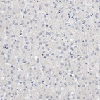 Immunohistochemical staining of human liver shows no positivity in hepatocytes as expected.