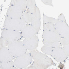 Immunohistochemical staining of human skeletal muscle shows no positivity in myocytes as expected.