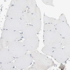 Immunohistochemical staining of human skeletal muscle shows no positivity in myocytes as expected.