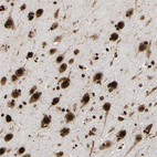 Anti-PSIP1 Antibody