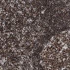 Immunohistochemical staining of human tonsil shows strong nuclear positivity in non-germinal center cells.