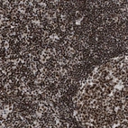 Immunohistochemical staining of human tonsil shows strong nuclear positivity in non-germinal center cells.