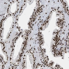 Immunohistochemical staining of human prostate shows strong nuclear positivity in glandular cells.