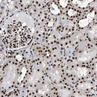 Immunohistochemical staining of human kidney shows strong nuclear positivity in cells in tubules.