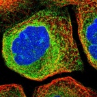 Immunofluorescent staining of human cell line A-431 shows localization to endoplasmic reticulum.
