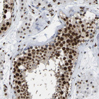 Anti-RBL2 Antibody