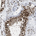 Anti-RBL2 Antibody
