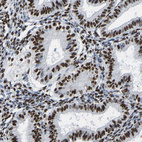 Immunohistochemical staining of human endometrium shows strong nuclear positivity in glandular cells.